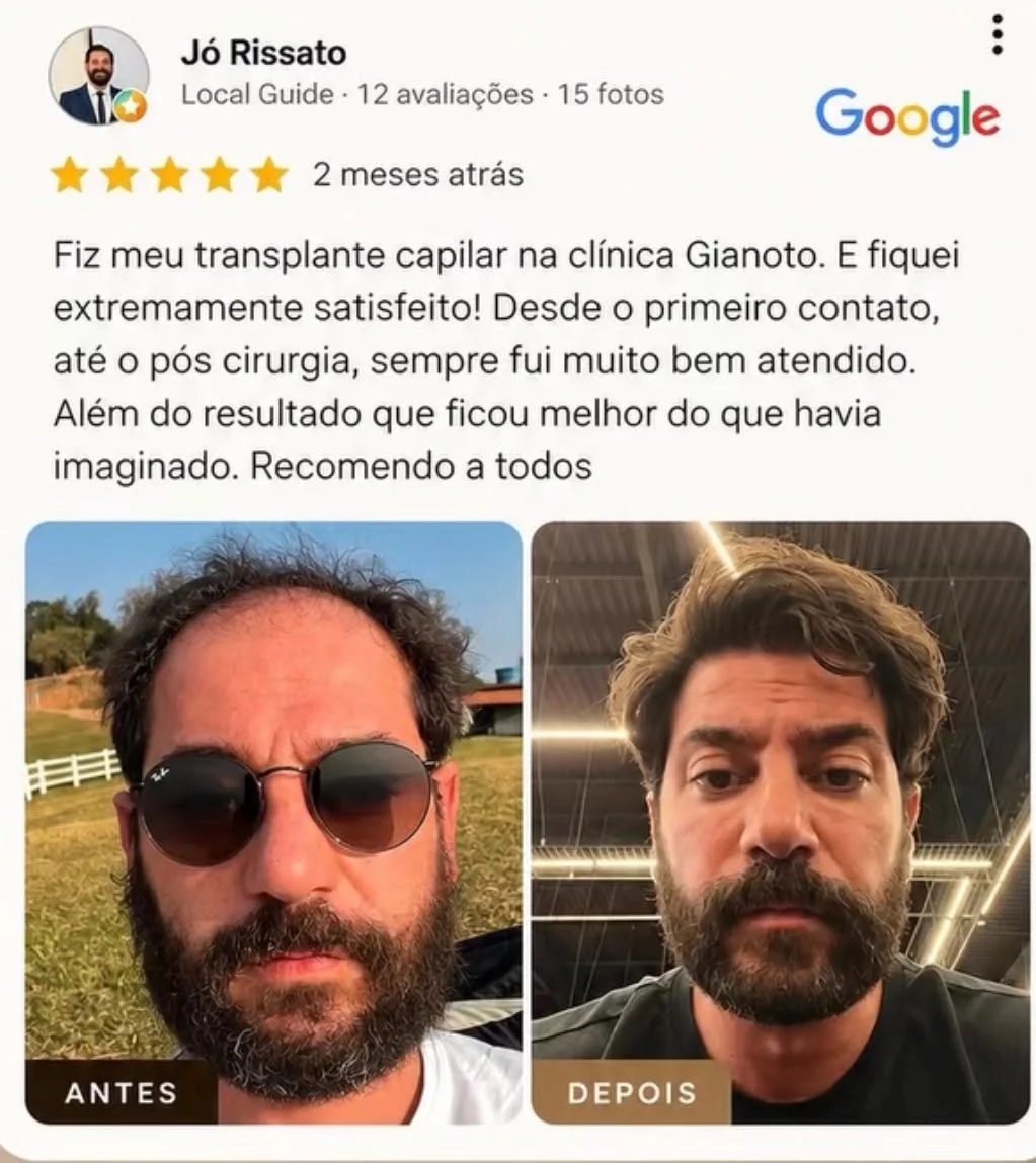 Avaliação de Jó Rissato no Google e fotografias de antes e depois enviadas pela Gianoto Hair